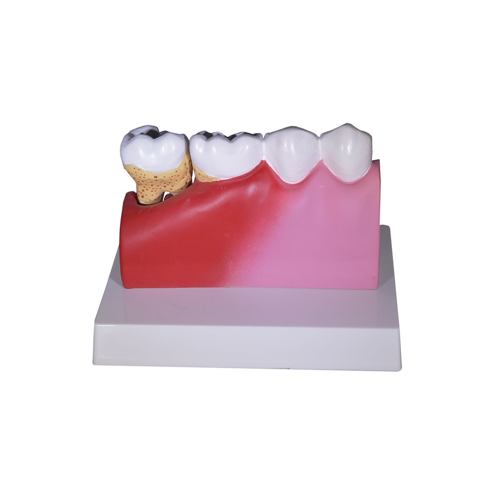 Redland Dental Demonstration Teeth Educational Model -3339 Model 4