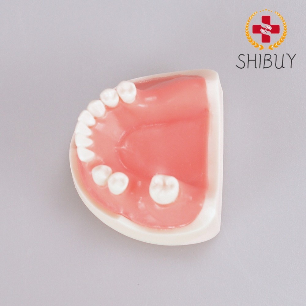 Dental Teeth Missing Implanting Typodont Training Dentistry Model Display