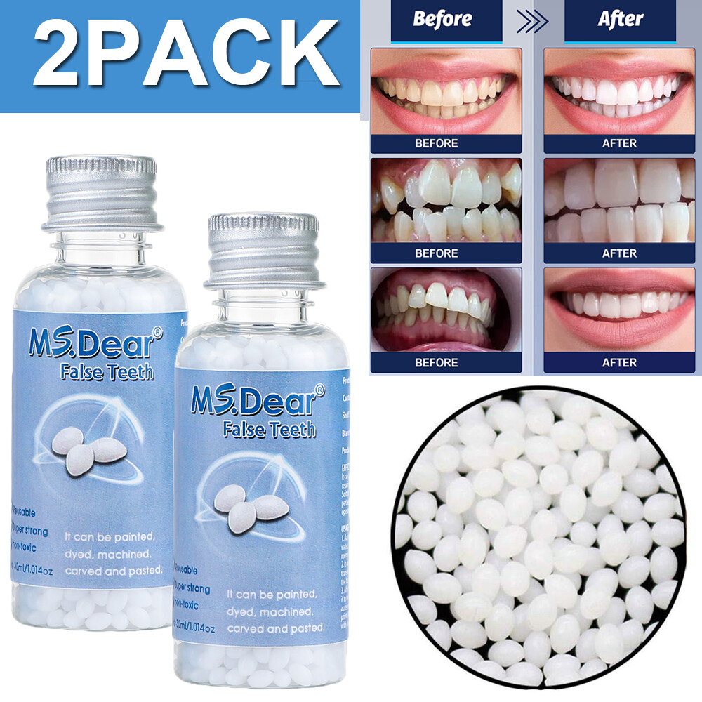 2PCS False Teeth Solid Glue Temporary Tooth Gap Filler Tooth Repair Moldable 30g