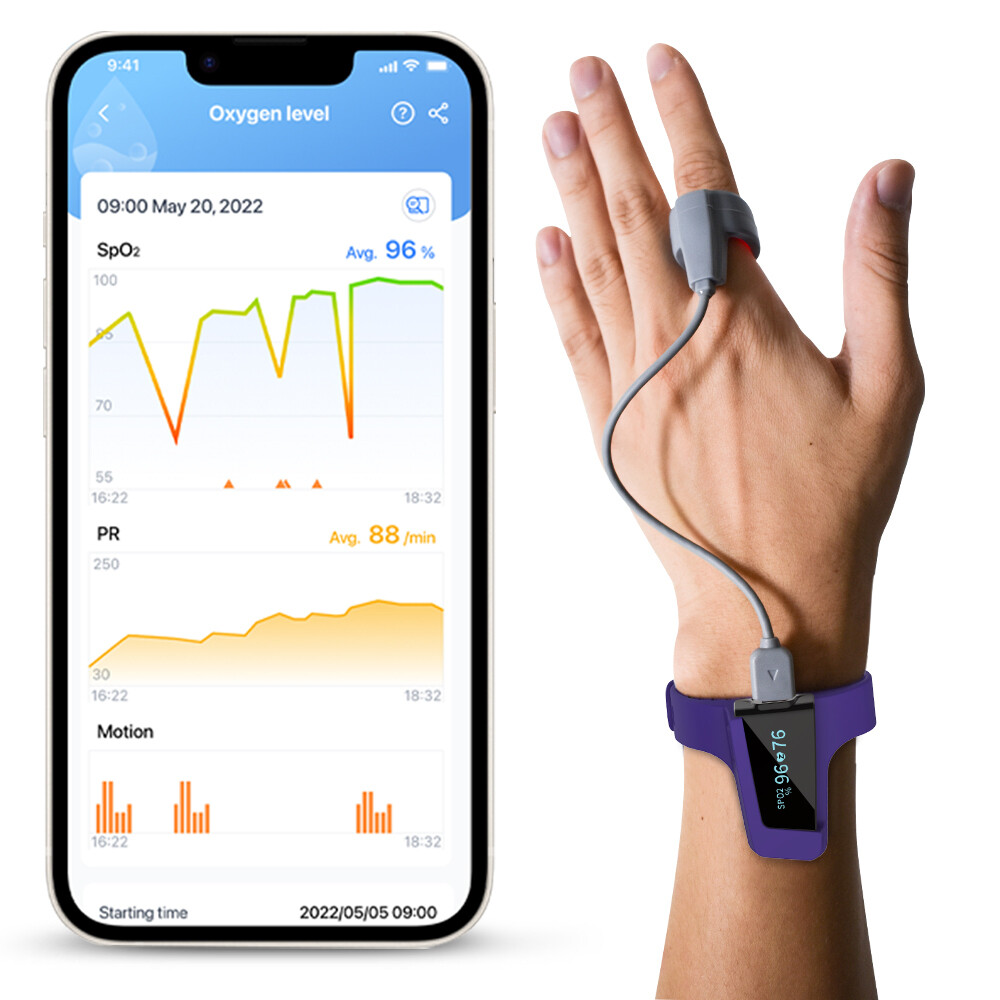 Wellue Pulse Oximeter O2 Sensor Ring for Checkme O2 Max, SleepU and Visual Oxy