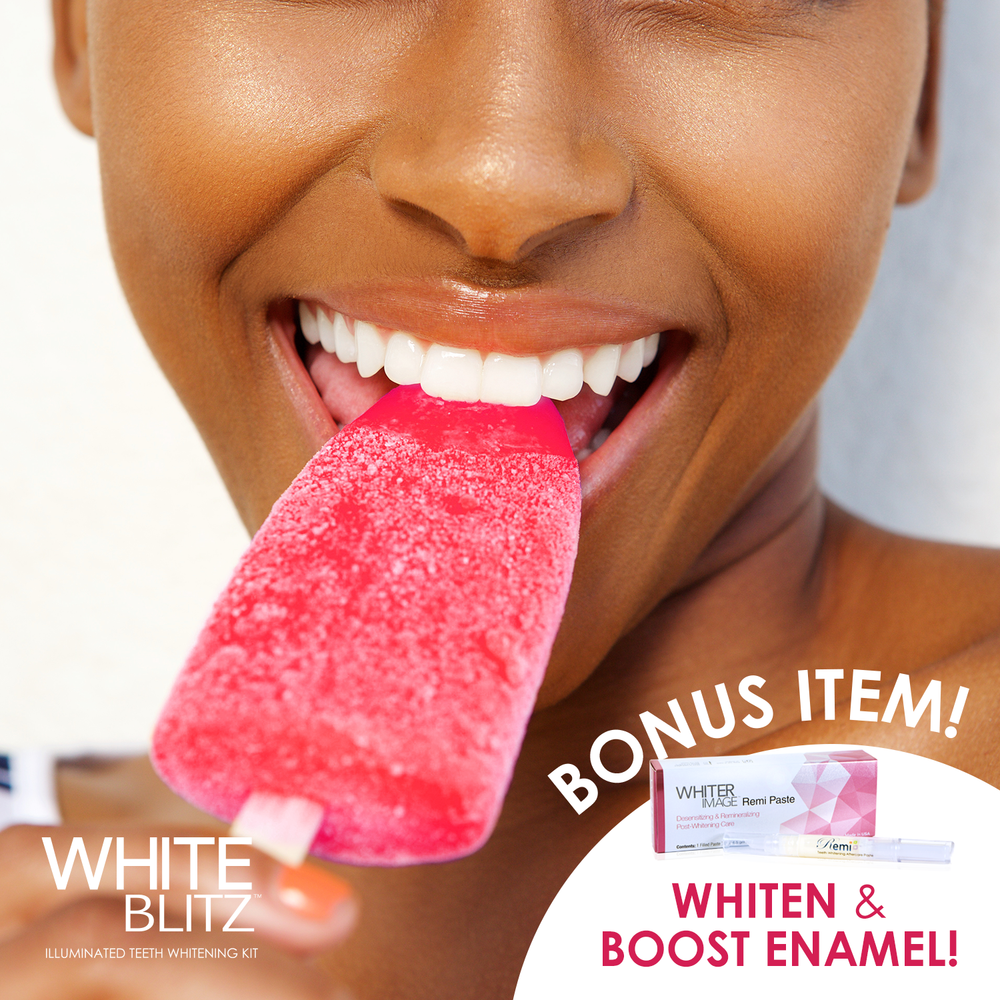 120 Application Complete White Blitz Illuminating Teeth Whitening Kit