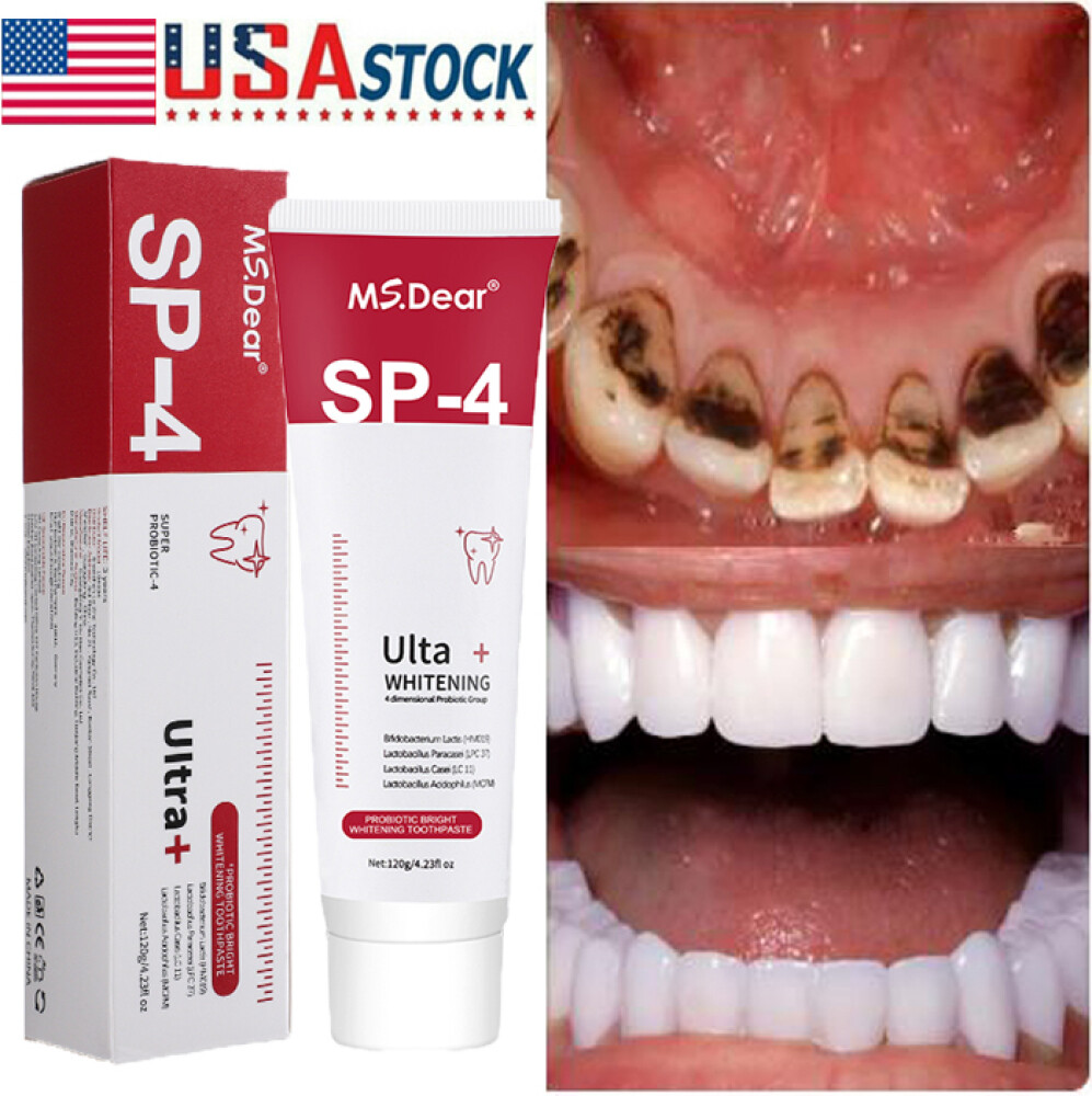 2xSip-4 Toothpaste, Whitening Sp-4 Toothpaste Bright White Toothpaste Toothpaste