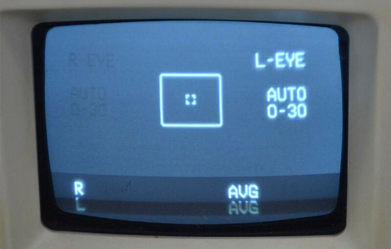 TOPCON CT-60 Computerized Tonometer[A02]