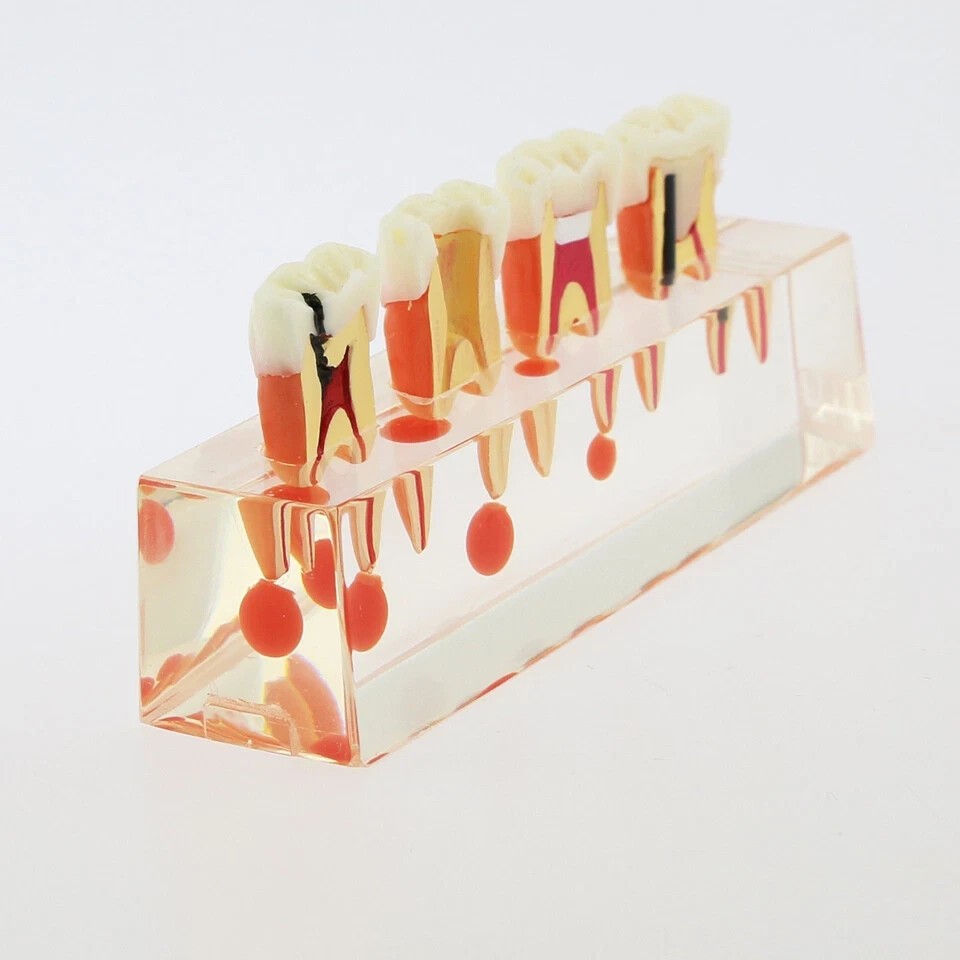 Dental Teeth Demonstrate Model #4018 Root Canal 4Stage Study Teaching Instrument