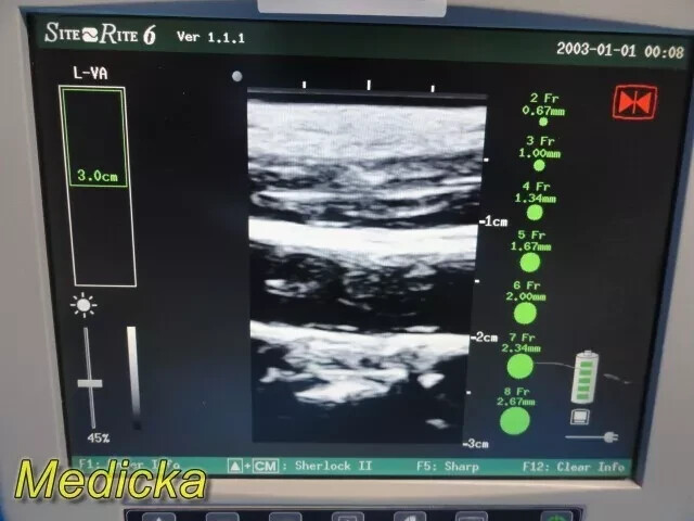 Chison Tech L-VA Linear Array Probe – Vascular Imaging for SR-6 (Tested) ~ 36100