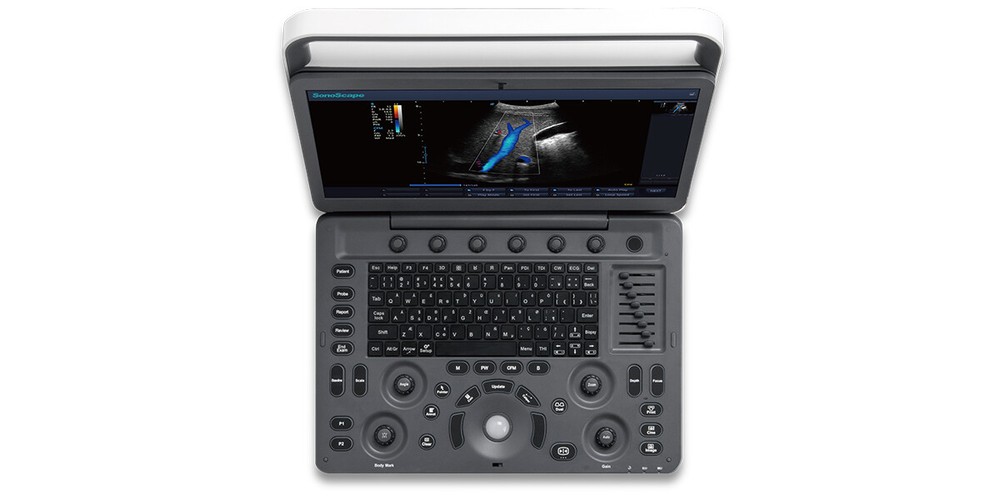 SonoScape E2 ultrasound & One linear array probe L741 Color doppler Vascular