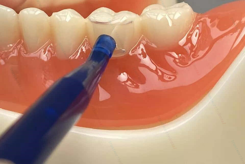 Dental Transparent Cervical Matrices Composite Gingival Retractor Clear Matrix