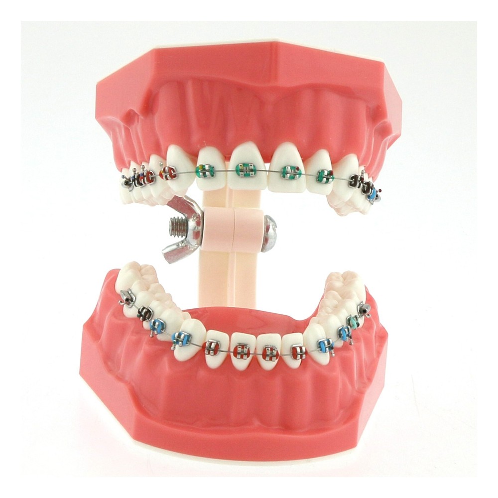 US Dental Typodont Brushing Flossing Practice Teeth Model with Metal Brackets