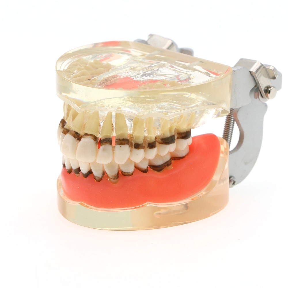 Multiple Types Dental Teeth Model Typodont Ortho Implant Practice Demo Teaching