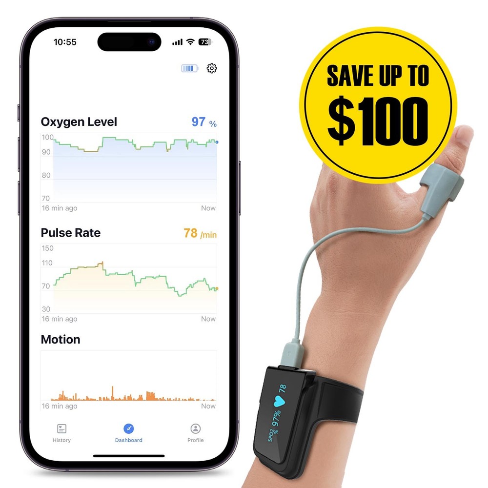 Refurbished Checkme O2 Max Pulse Oximeter with App/PC Software Continuous 72hrs