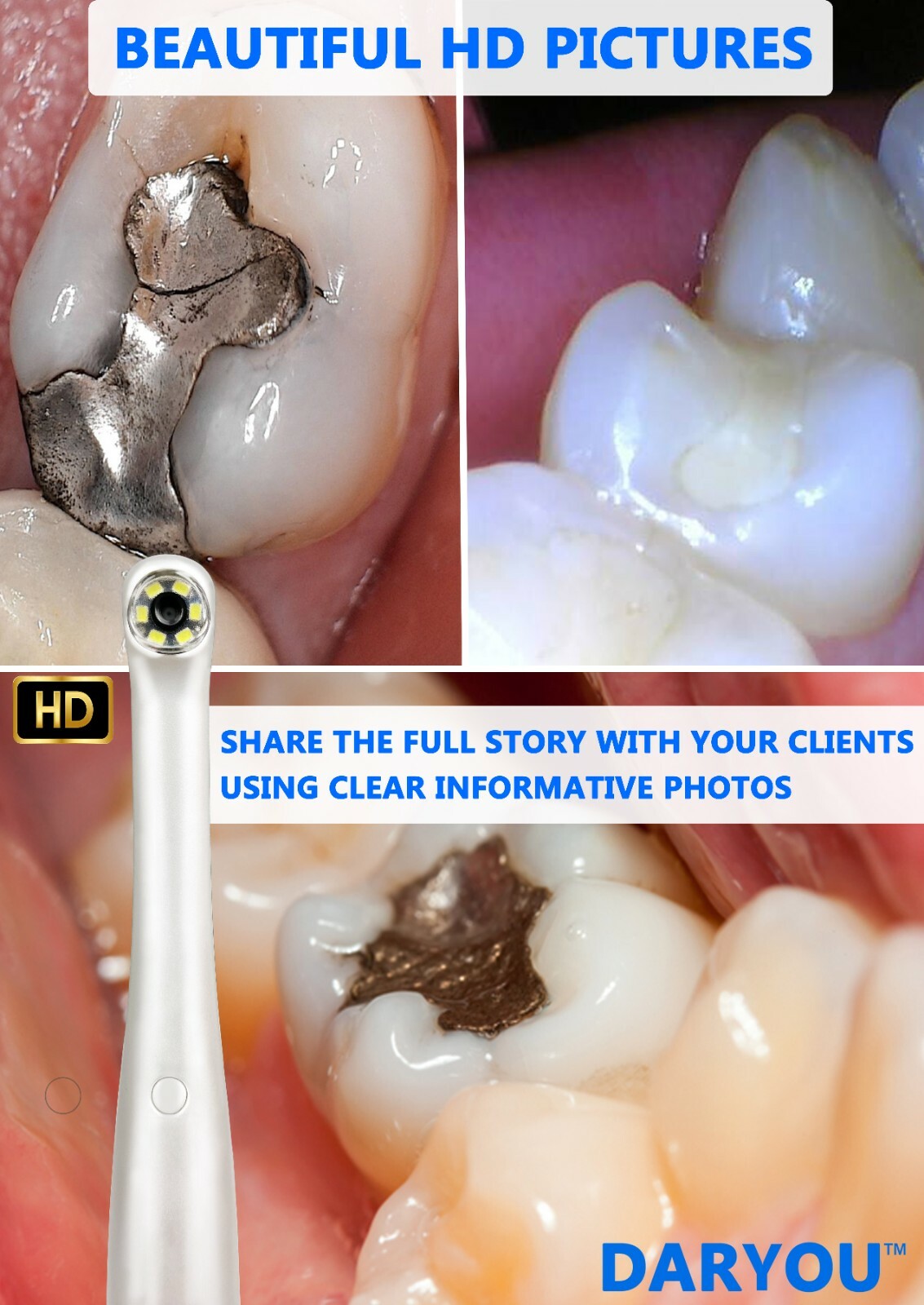 DARYOU DY-60 720P HD Intraoral Camera Dental Camera,Button Work Dexis,Eaglesoft