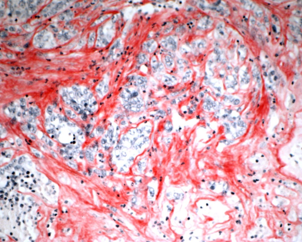 VitroView™ Picro-Sirius Red Stain Kit (Cat# VB-3017)