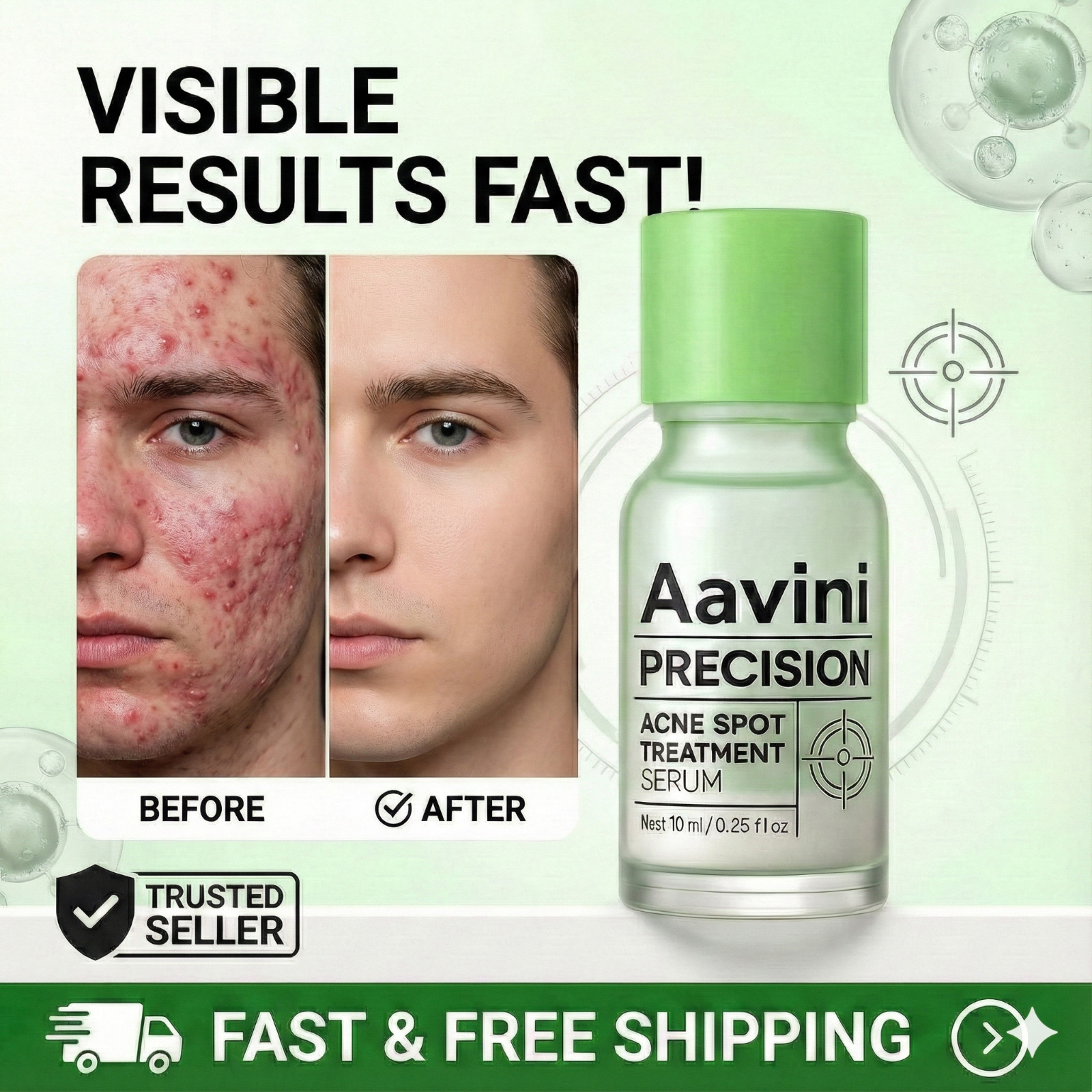 Severe Acne Pimple Treatment Serum Cystic Spot Remover Reduce Redness Swelling