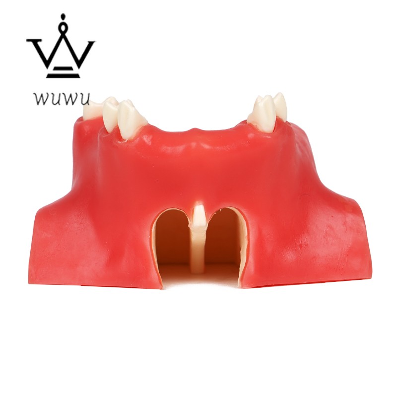 Dental Implant Teaching Model Upper Jaw Maxillary Sinus Model