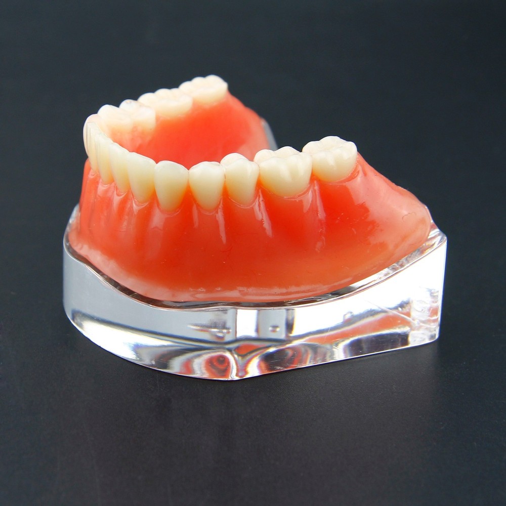 Dental Overdenture Teeth Model Inferior Precision Implants Demonstration Golden