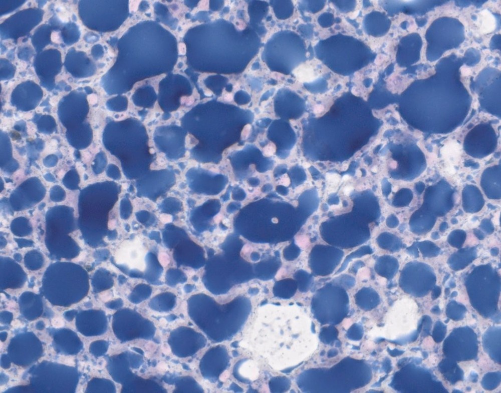 VitroView™ Sudan Black B Lipid Stain Kit (VB-3012)