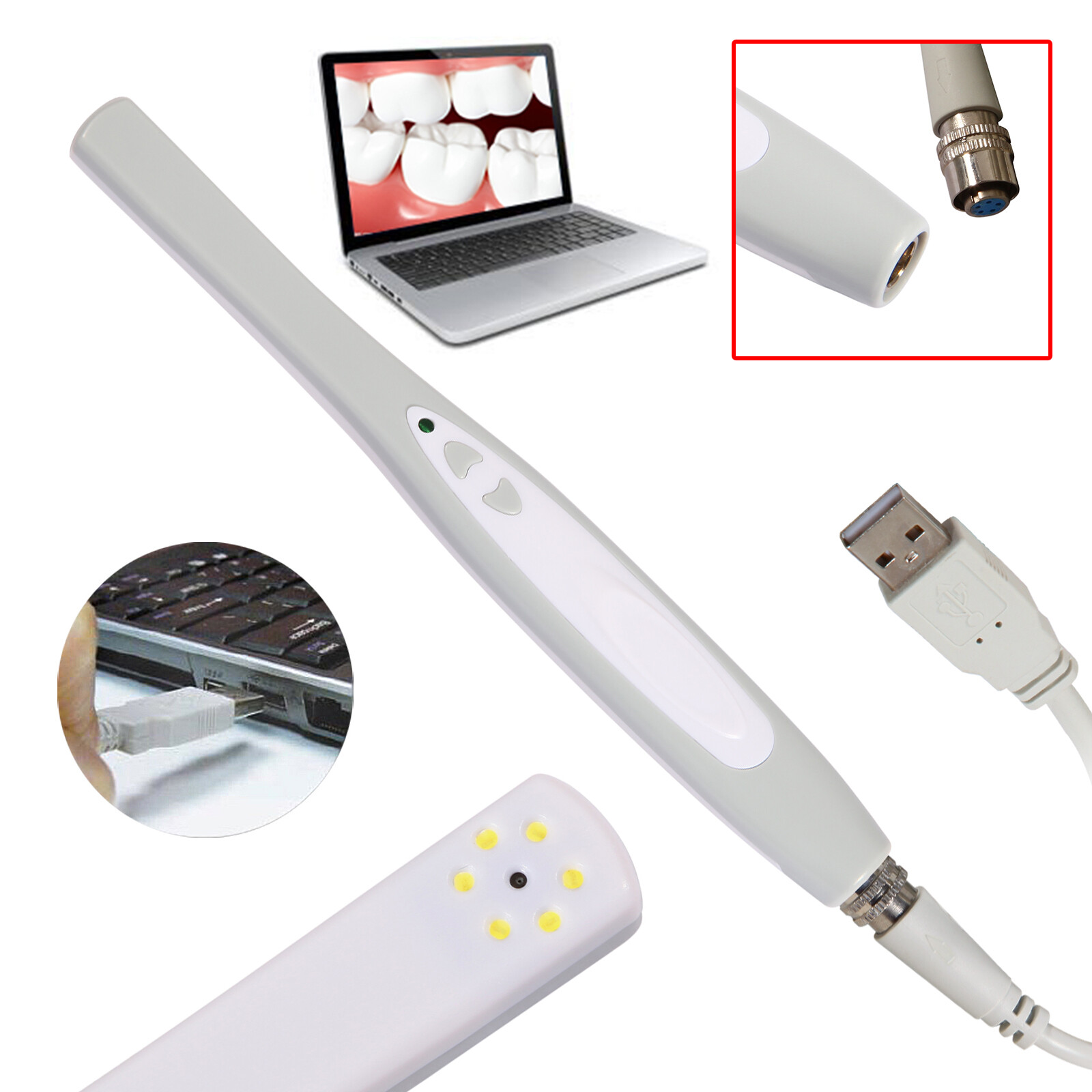 CAM MD740 Dental Intraoral Camera USB Digital Imaging Intra Oral USB-X