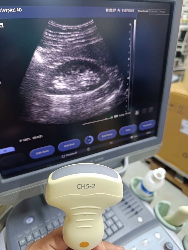 Siemens Convex Probe CH5-2