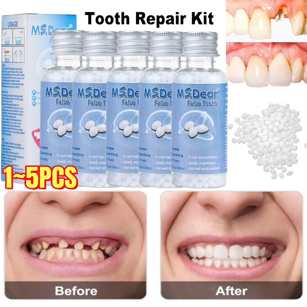 Tooth Repair Granules Temporary Kit Fitting Beads Reusable Moldable False Teeth~