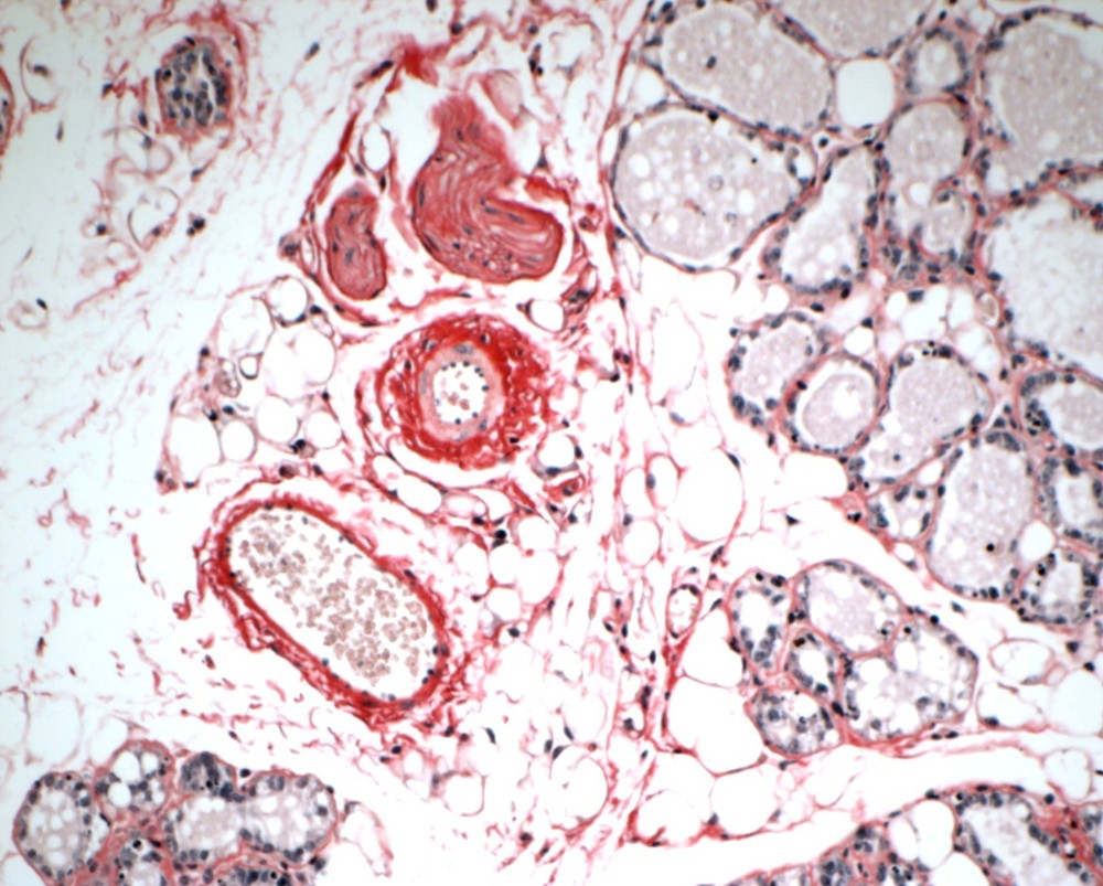 VitroView™ Picro-Sirius Red Stain Kit (Cat# VB-3017)