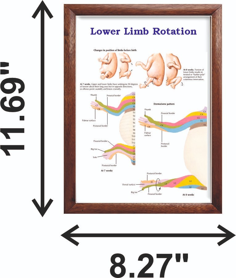 Lower Limb Rotation Chart 12x18 inches