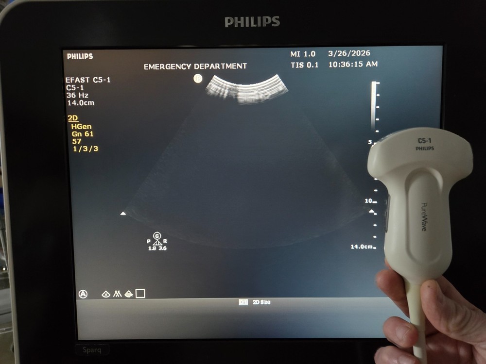 Philips C5-1 Curved Array Transducer - Working - Cord Damage