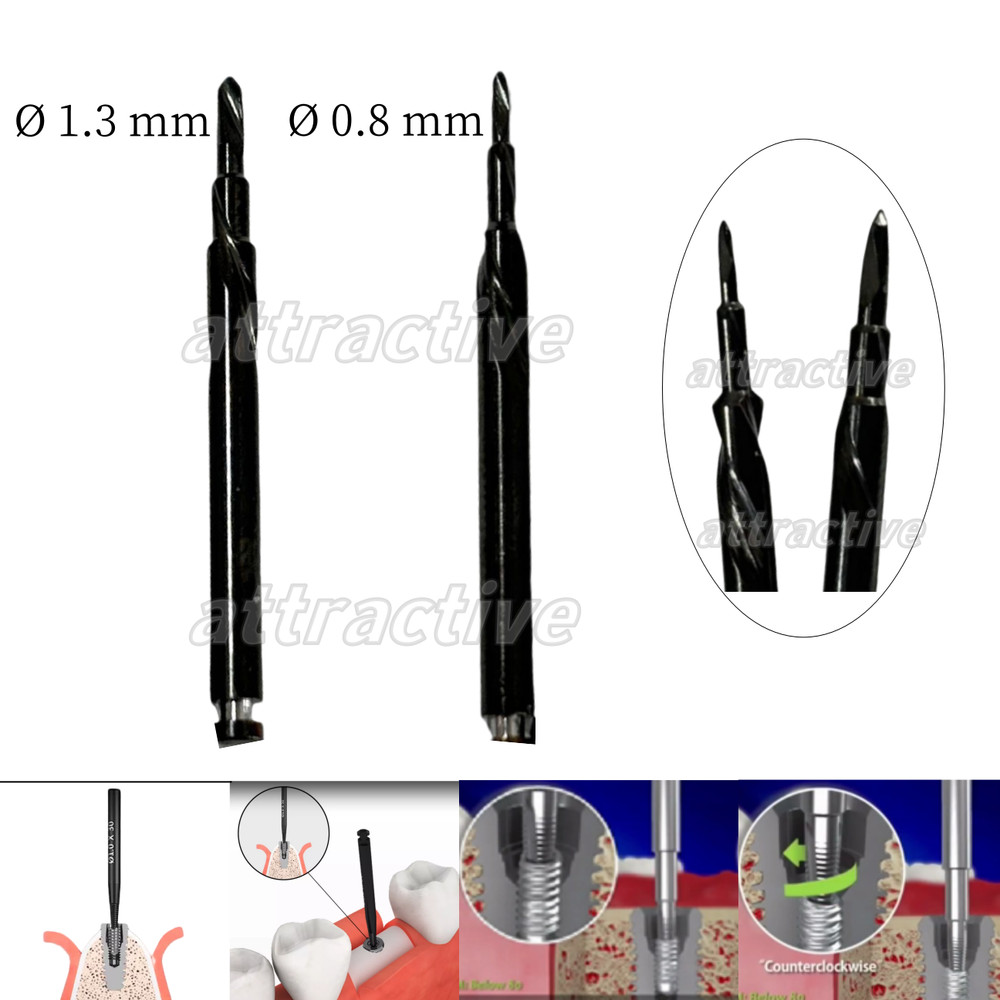 Dental Broken Abutment Reverse Screw Extractor Drill Failed Fixture Remover Tool