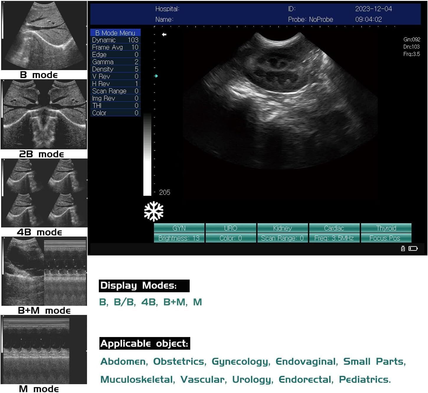 VET Veterinary Portable Ultrasound Scanner Machine Sheep Goat Pig Convex Probe