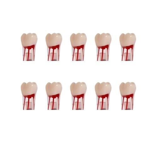 Dental Endo Root Canal Practice Teeth Model Pulp Study Practice Pulp Cavity #26