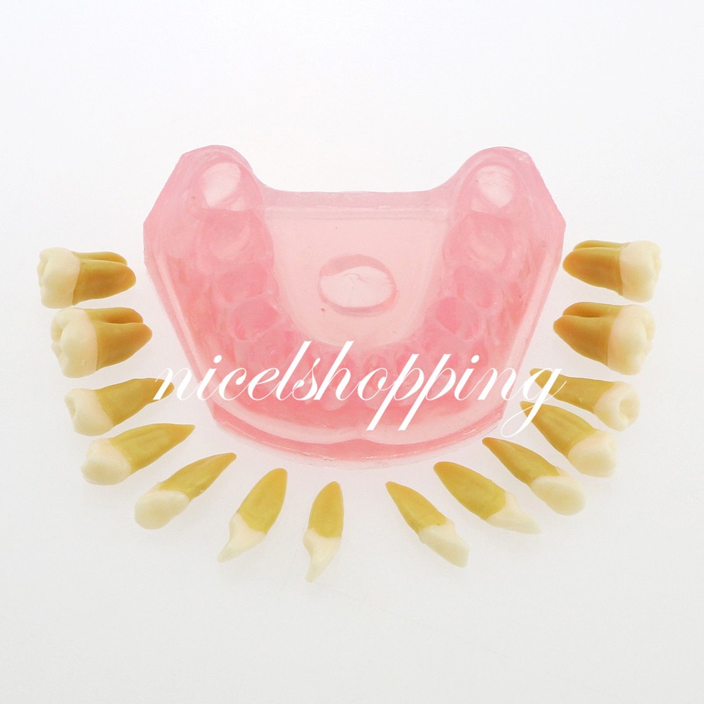 Dental Orthodontic Teeth Model 4004# with 28 Removeable Teeth Standard Plastic