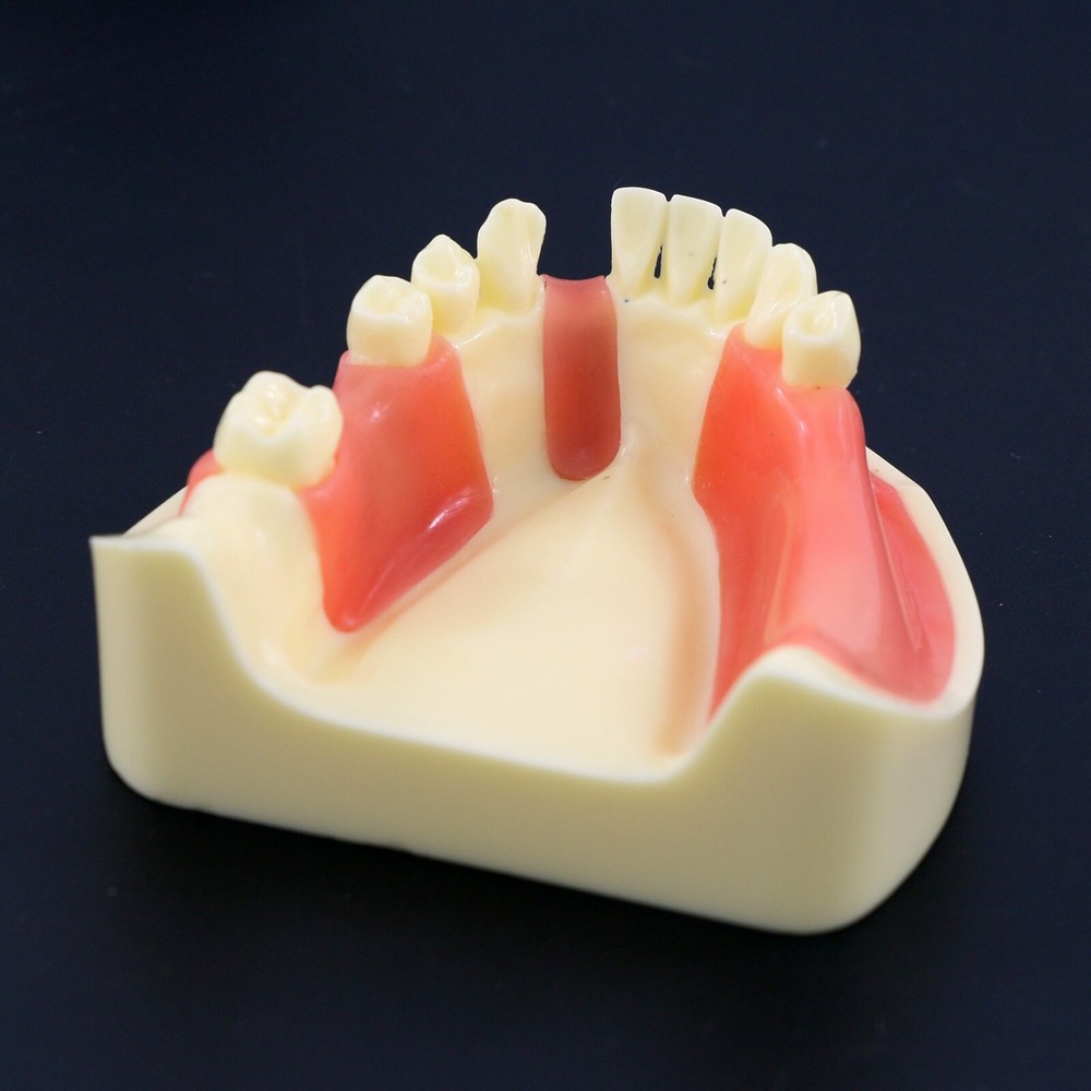 M2004 Dental Implant Practice Typodont Lower Jaw Teeth Model Gingiva Removable
