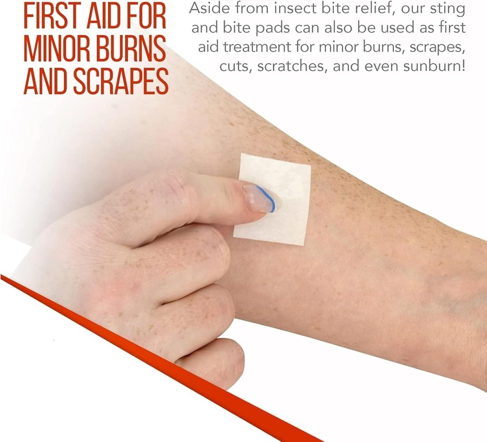 Insect Sting / Bite Relief Pads - 50 Count/Pkg - Dynarex