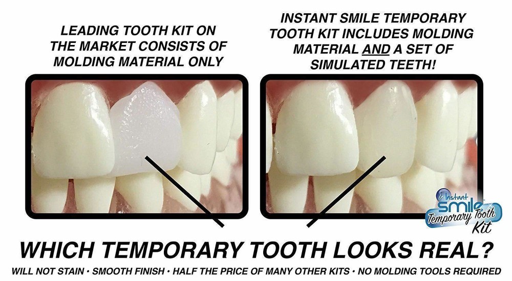 Instant Smile Emergency Temporary Tooth Replacement Kit Teeth