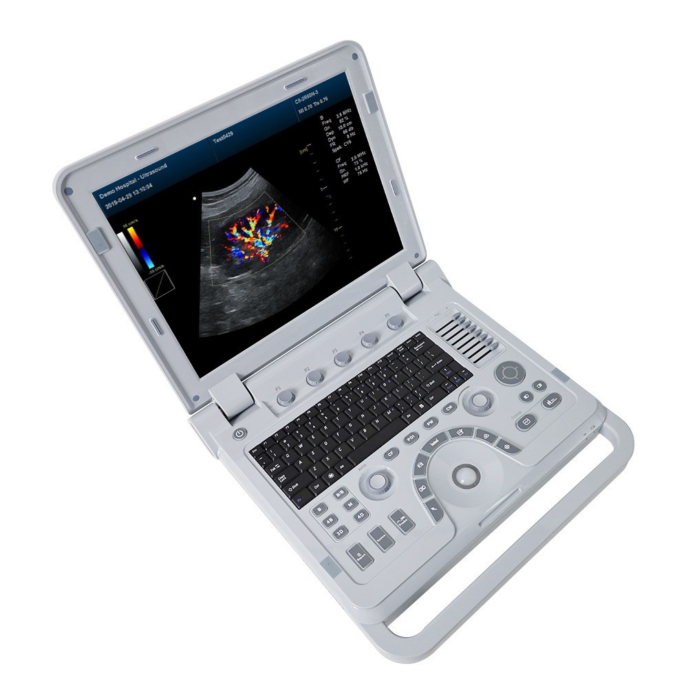 Portable Color Doppler Ultrasound Scanner Machine DiagnosticSystem Convex Linear