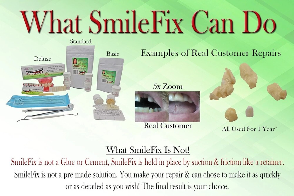 SmileFix Basic Dental Repair Kit - Missing or Broken Tooth. Gaps Broken Teeth...