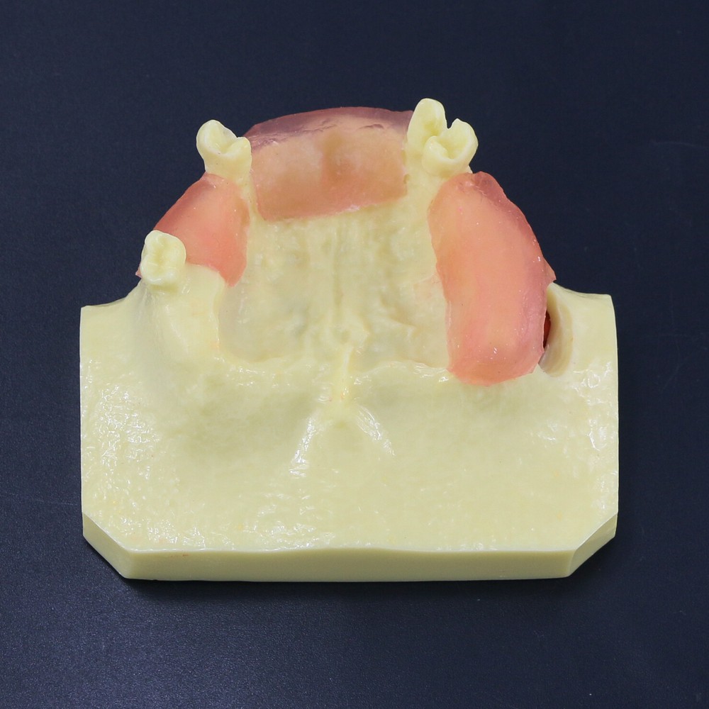 Dental Typodont Teeth Model Sinus Lift Practice Study Teach Demo Model 2012 2013