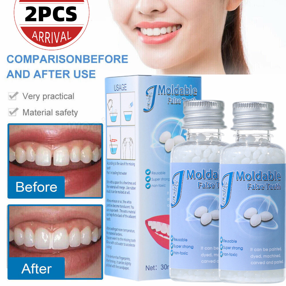 2X Tooth Repair Granule Temporary Kit Fitting Bead Reusable Moldable False Teeth