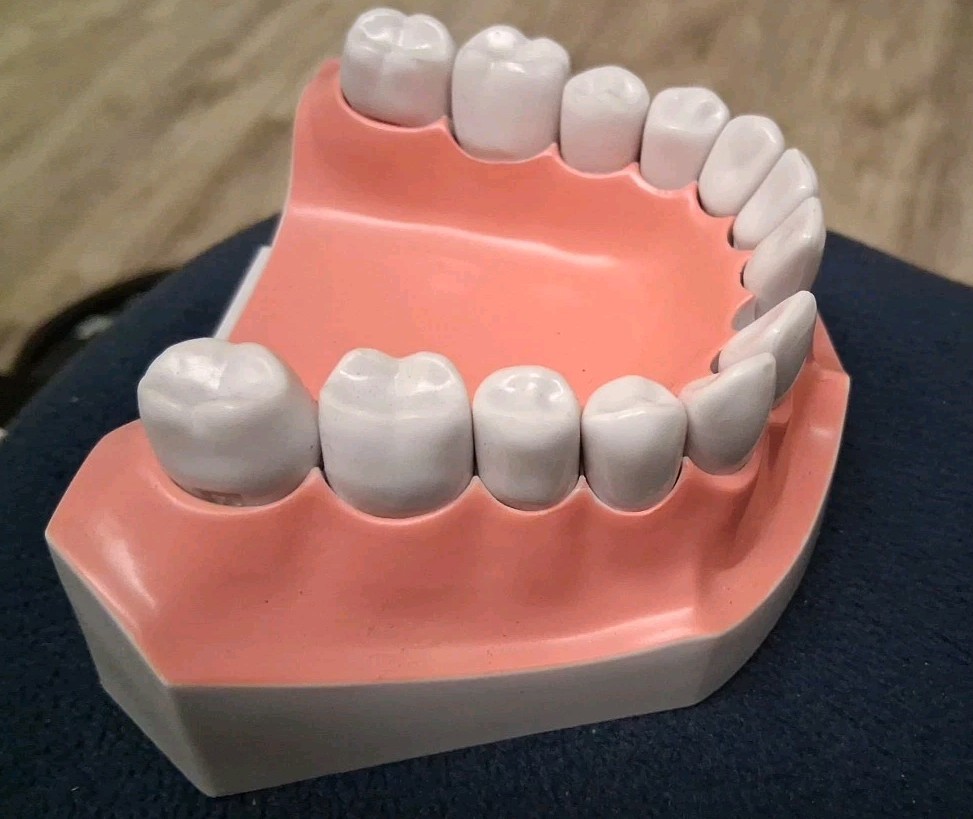 Bottom Teeth Model With Removable Teeth One Missing