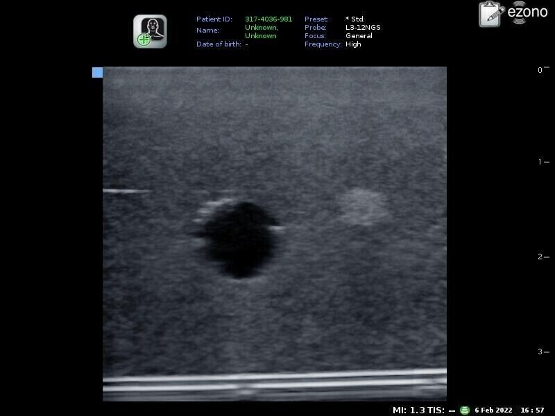 4 set simple ultrasound phantom training model-nerve and vessel