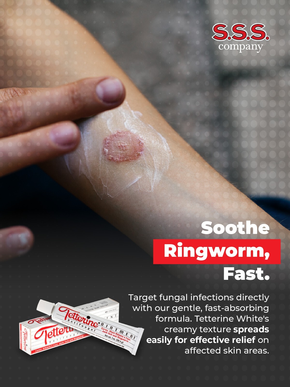 Tetterine Antifungal Cream for Athlete's Foot, Jock Itch, Ringworm - 1 oz