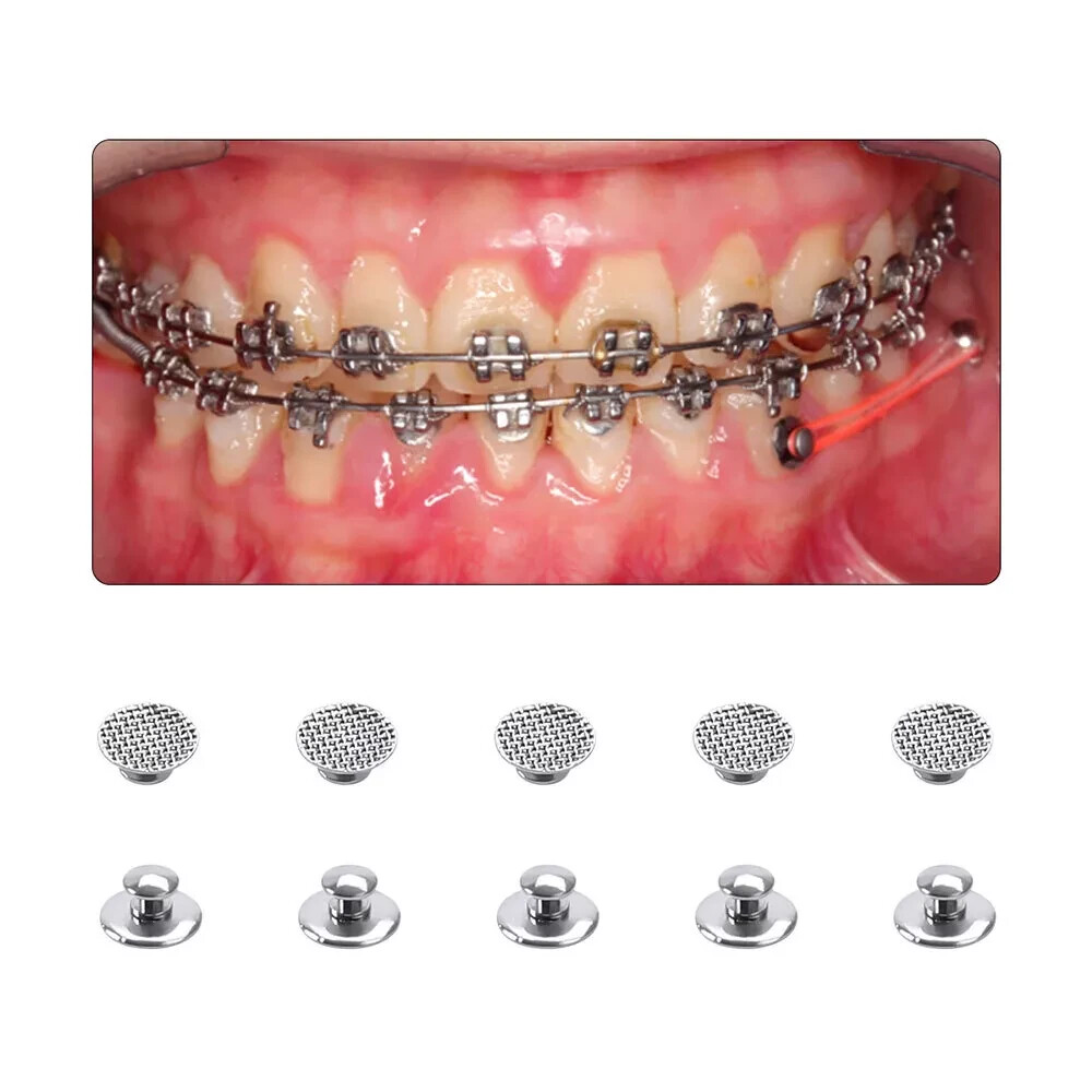 32Models Dental Orthodontic Bondable Lingual Buttons Round/Rectangular Base