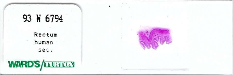 Human Rectum Microscope Slide