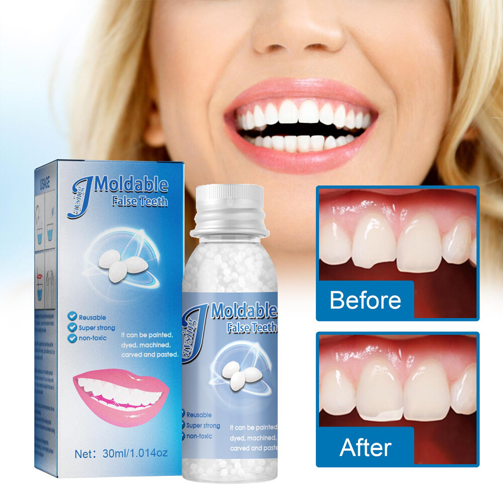 Resin False Teeth Solid Glue Temporary Tooth Repair Set Moldable Teeth And Gap
