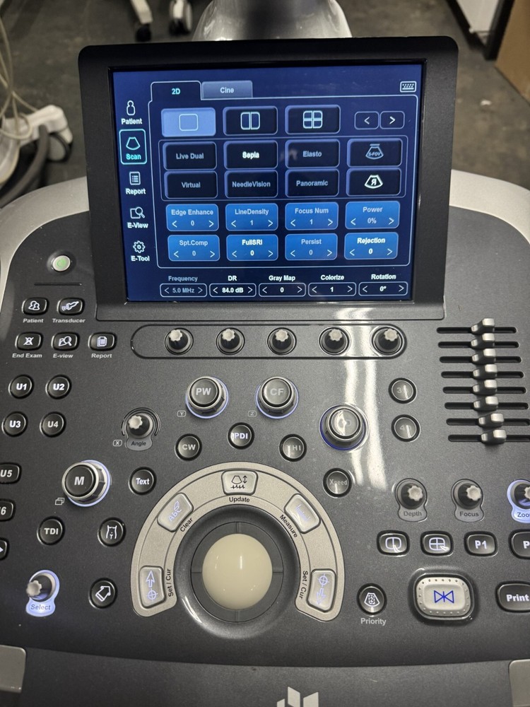 ALPINION ECUBE 11 ULTRASOUND SYSTEM
