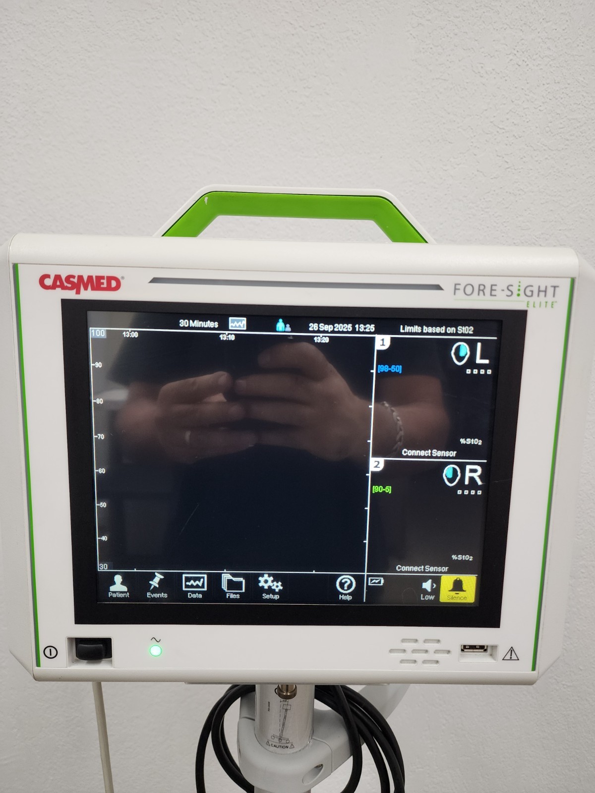 CasMed 01063000 Fore-Sight Elite Absolute Tissue Oximeter with Roller Stand