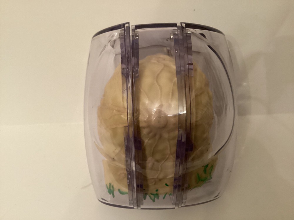 Anatomical Breast Model, 3 Part, 3d Cross-sections, Magnetic Closure, Anomaly