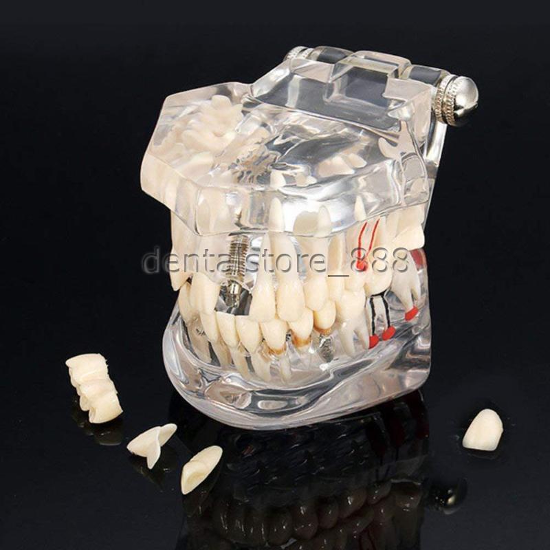 3D Human Teeth Gums Model Dentist Training Teaching Education