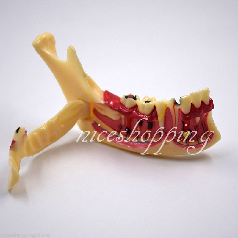 1X Dental Mandibular Tissue Teeth Anatomical Model Patient Teach Study Education