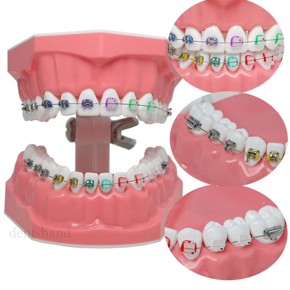 Dental Typodont Teeth Model 1:1 Teach Study Half Metal Ceramic Brackets Tubes