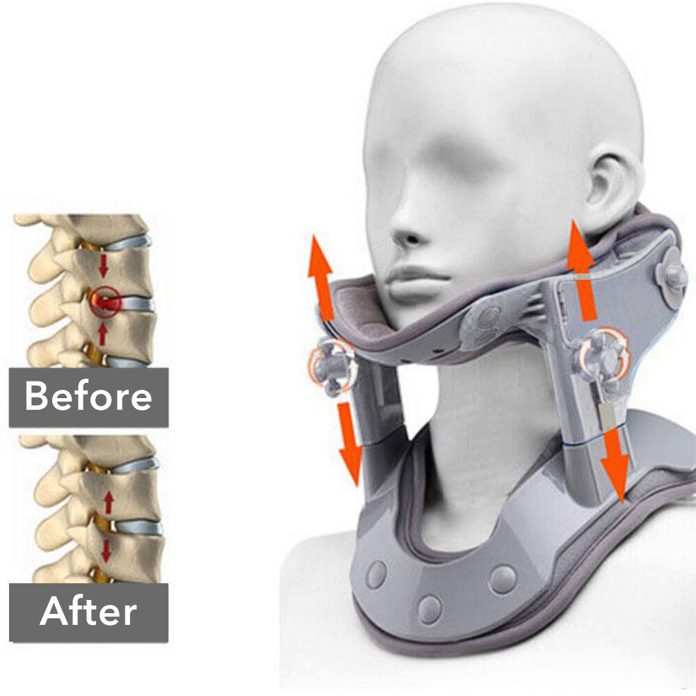 Neck Traction Device Cervical Correction Kit Neck Retractor Stretcher 222